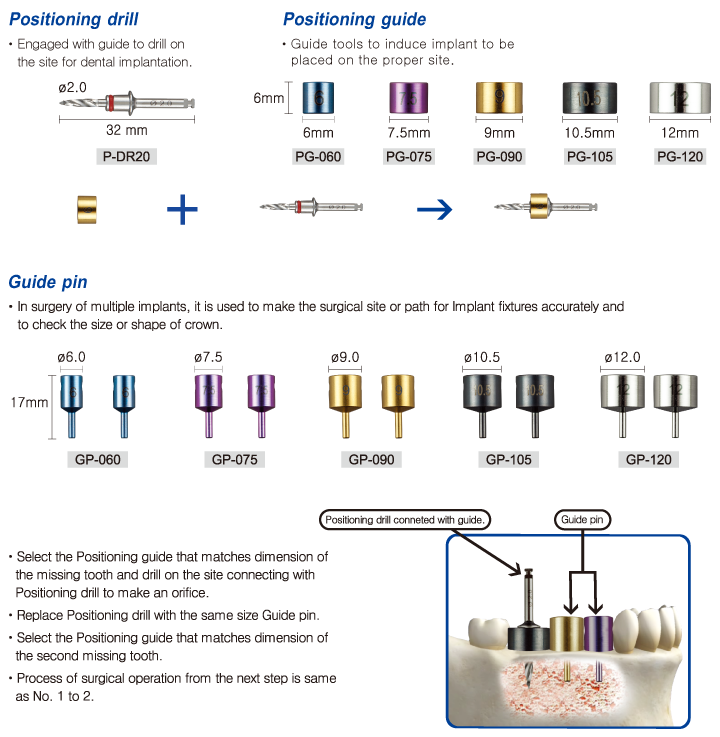 Positioning Implant Instruments Implant Positioning KIT – Dental Hub International